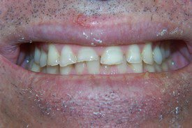 Before treatment, case 1