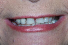 Before treatment, case 2