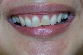 Before treatment, case 3