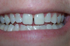 Before treatment, case 4