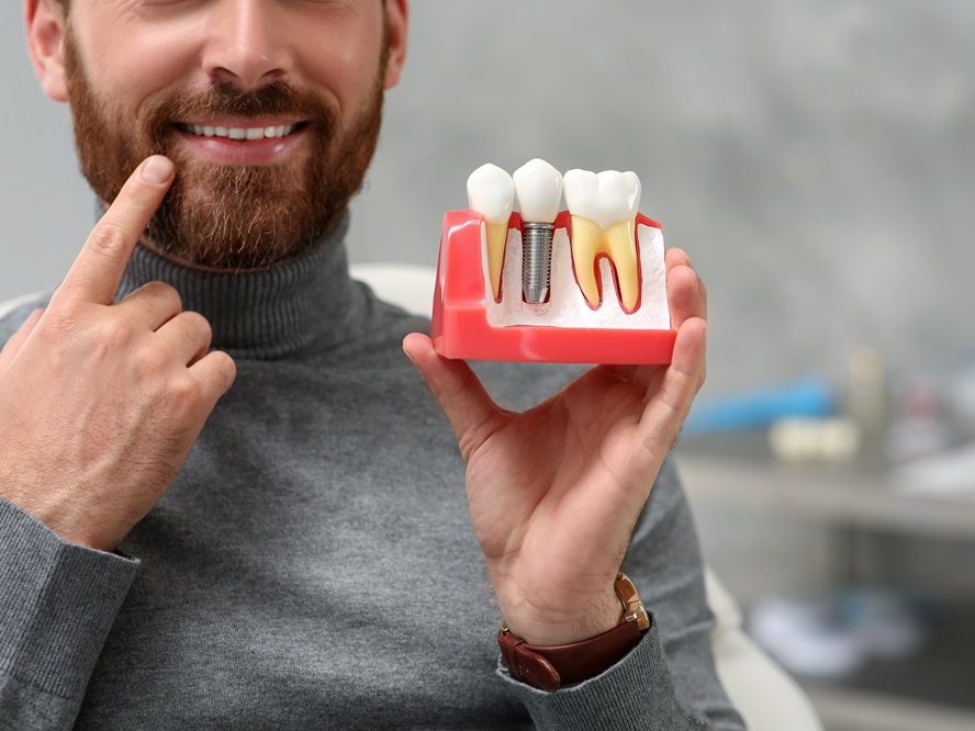 A dentist holding a model of a dental implant