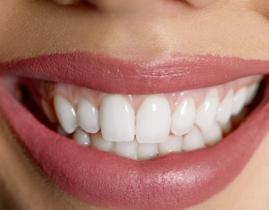 Cosmetic Dentistry