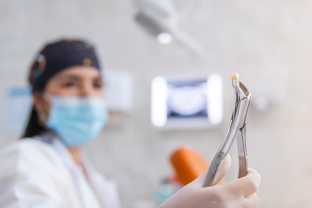 Dentist holding extracted tooth with forceps - Rancho Bernardo Dentist Close-up of dentist in mask holding tooth with extraction tool after procedure - Rancho Bernardo Dentist